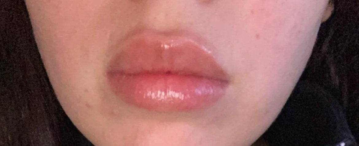 Lip Plumper Ulta